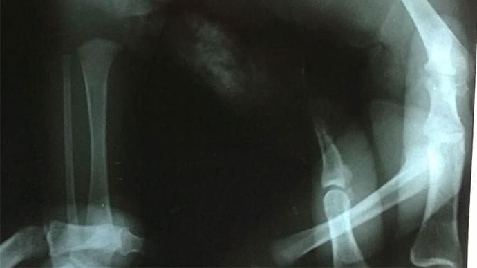 deficiencia-2