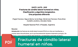 fractura-condilo-lateral