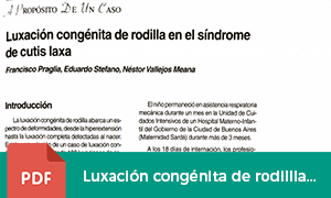 luxacion